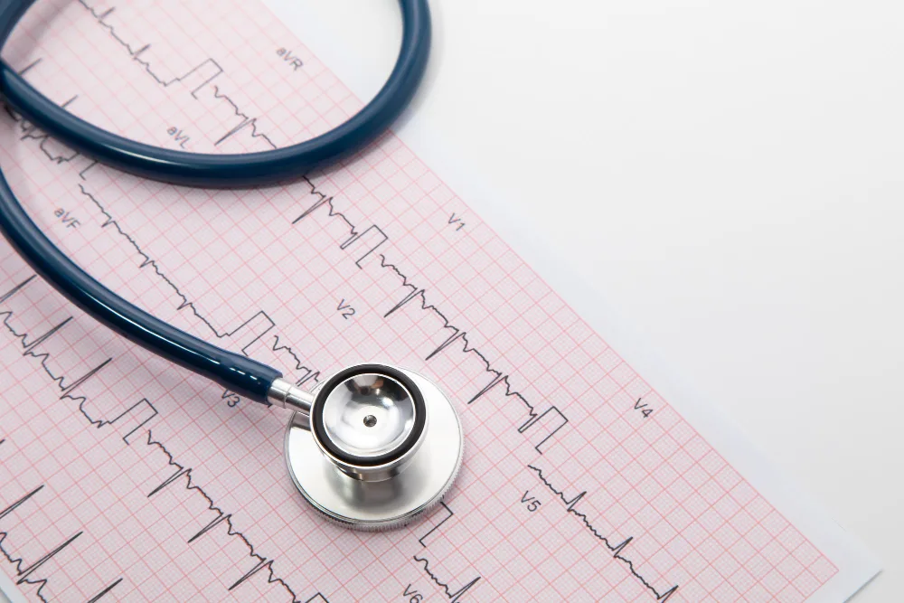 Electrocardiograma como parte de la evaluación médica integral en CDMX, México